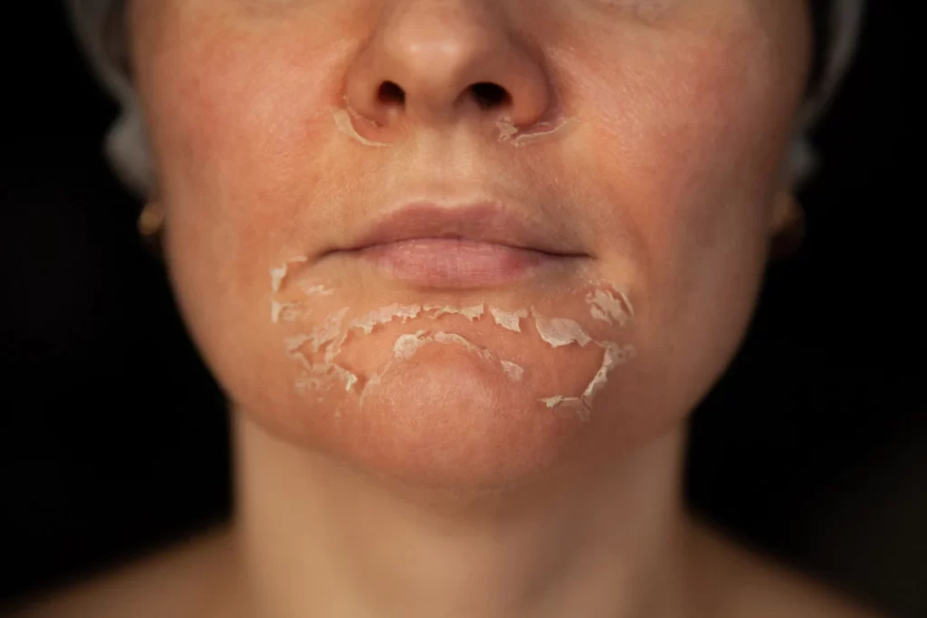 Old woman with dry mouth due to use of supplements of muscle relaxants