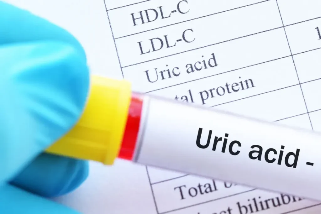 High levels of uric acid is dangerous.